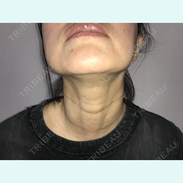 Alohaさおり自由が丘クリニック 藤堂紗織医師の症例