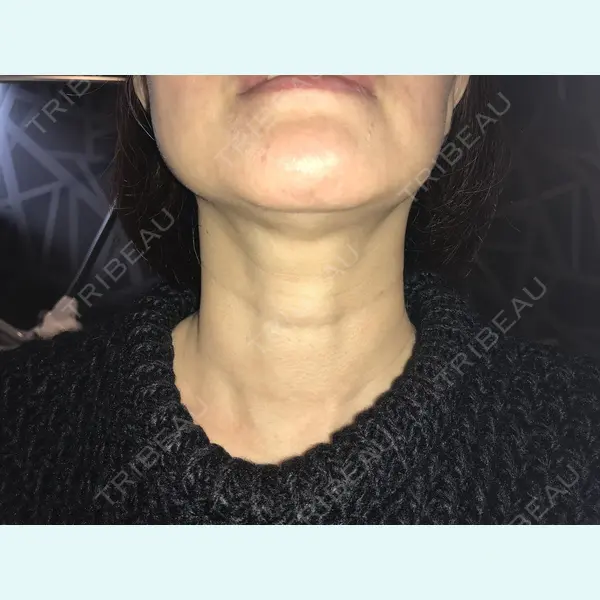 Alohaさおり自由が丘クリニック 藤堂紗織医師の症例