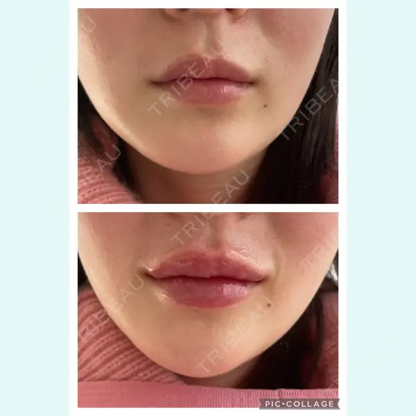 麻布十番クレールデンタルクリニック 藤田 亜樹医師の症例