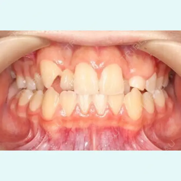 宇田川歯科医院 喜田 壮馬医師の症例