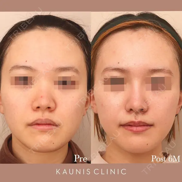 KAUNIS CLINIC（カウニスクリニック） 高野 敏郎医師の症例