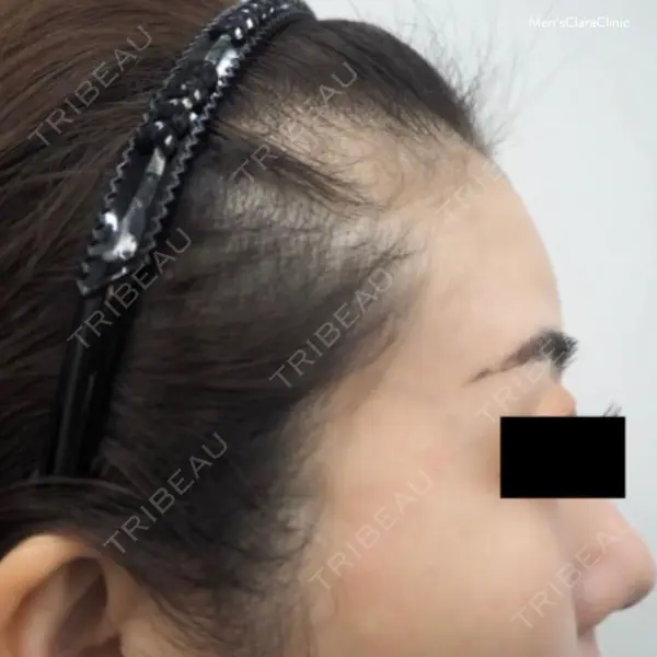 メンズクララクリニック 神林 由香医師の症例