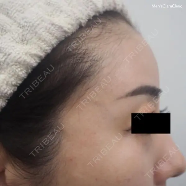 メンズクララクリニック 神林 由香医師の症例