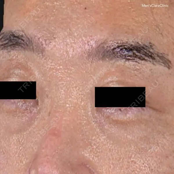 メンズクララクリニック 神林 由香医師の症例