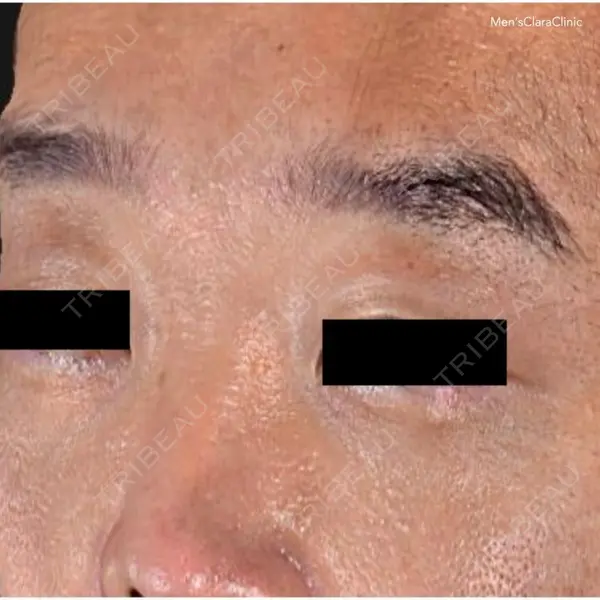 メンズクララクリニック 神林 由香医師の症例