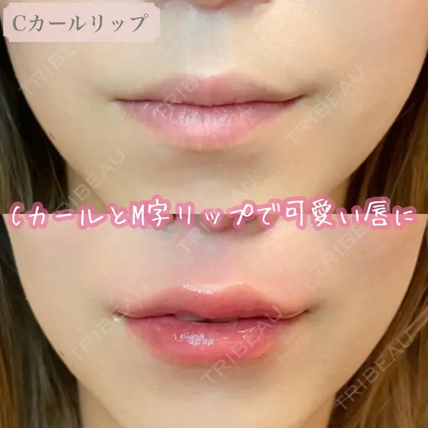 ルラ美容クリニック 大阪本院の症例