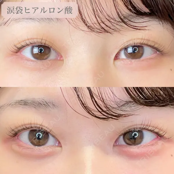 ルラ美容クリニック 大阪本院の症例