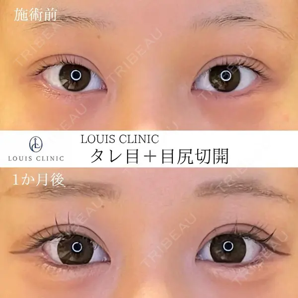 LOUIS CLINIC 二子玉川院【ルイクリニック】 小松 塁医師の症例