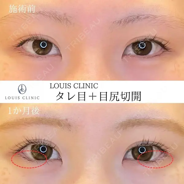 LOUIS CLINIC 二子玉川院【ルイクリニック】 小松 塁医師の症例