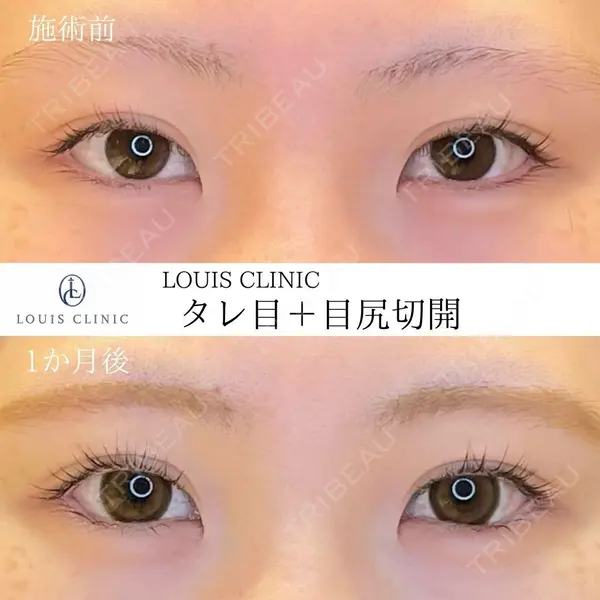LOUIS CLINIC 二子玉川院【ルイクリニック】 小松 塁医師の症例