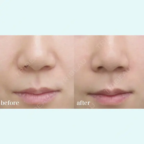 CHARIS BEAUTY CLINICの症例