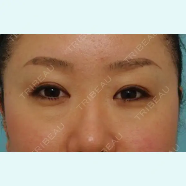 八事石坂クリニック 名古屋駅前院 大口春雄医師の症例