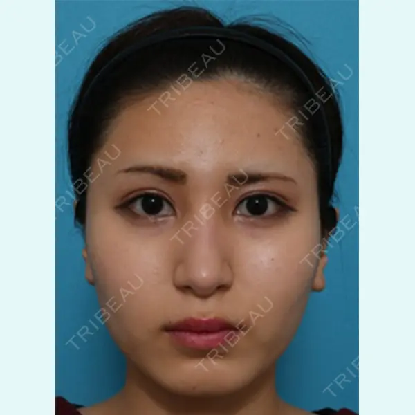 八事石坂クリニック 名古屋駅前院 大口春雄医師の症例