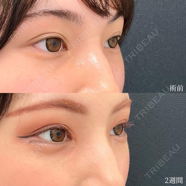 東京シンデレラ美容外科 大宮院の症例