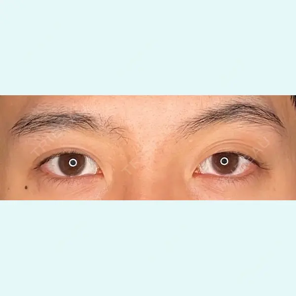Wi Clinic（ウィ クリニック） 吉祥寺院の症例