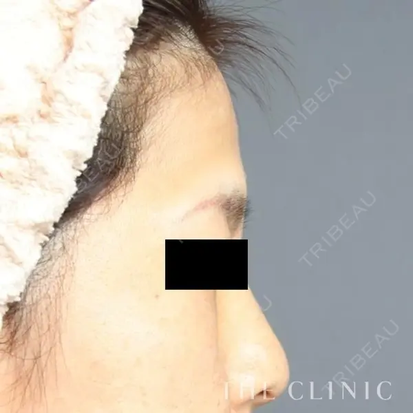 THE CLINIC（ザ・クリニック） 東京院 大橋 昌敬医師の症例