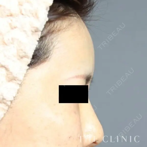 THE CLINIC（ザ・クリニック） 東京院 大橋 昌敬医師の症例