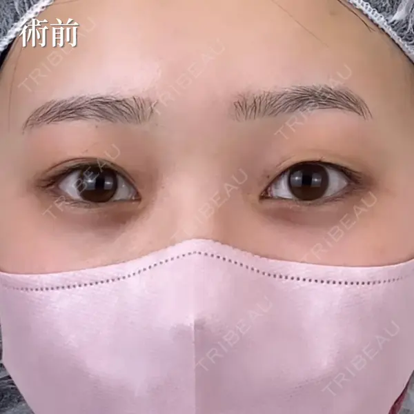 NARU Beauty Clinic 【ナルクリ】 石橋 成彦医師の症例