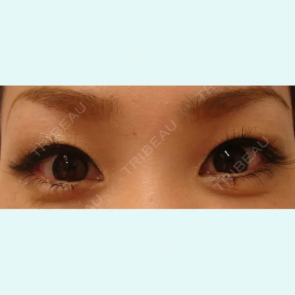 六本木 わかばクリニック 工藤　清加医師の症例