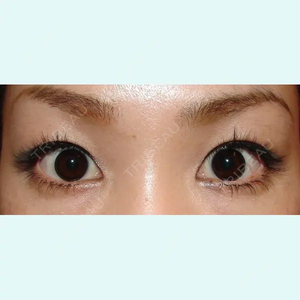 六本木 わかばクリニック 工藤　清加医師の症例