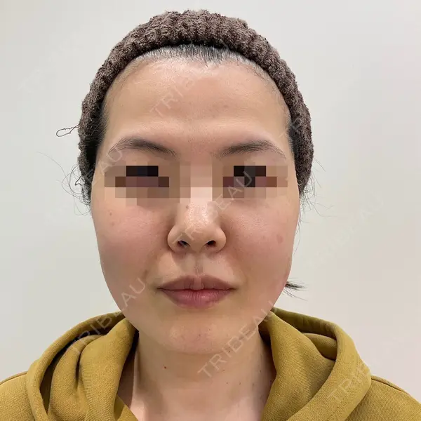 ユウコ形成外科クリニック 植田　有子医師の症例
