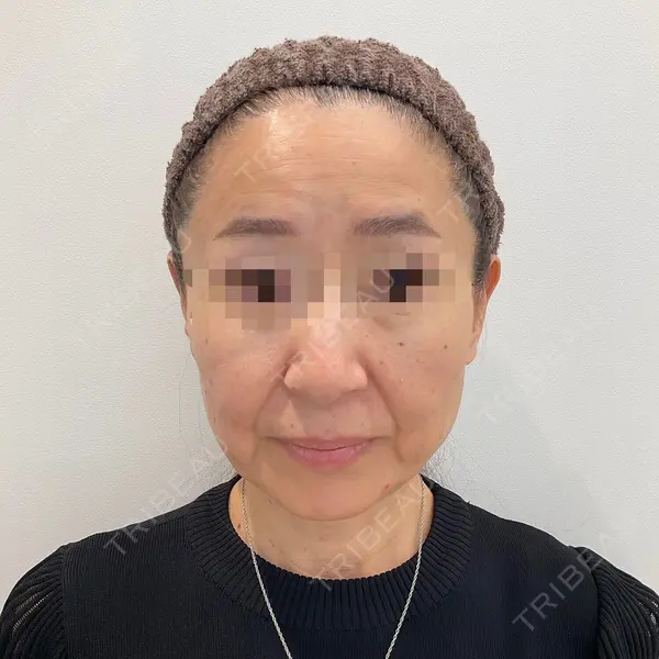 ユウコ形成外科クリニック 植田　有子医師の症例