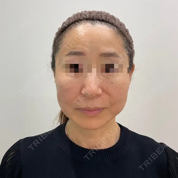 ユウコ形成外科クリニック 植田　有子医師の症例