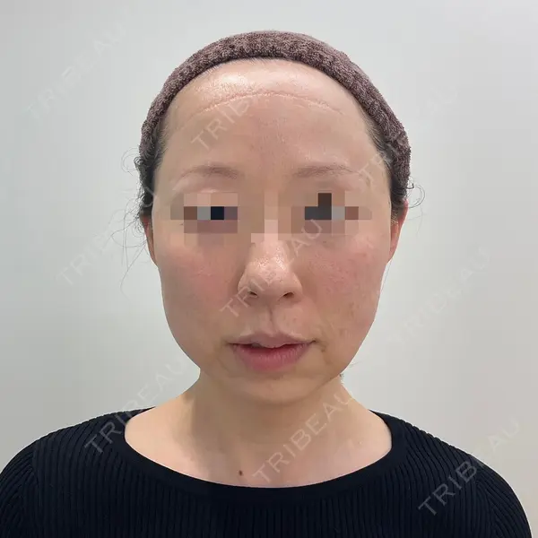ユウコ形成外科クリニック 植田　有子医師の症例
