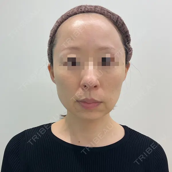 ユウコ形成外科クリニック 植田　有子医師の症例