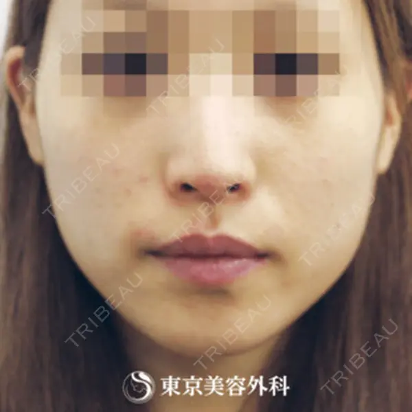 東京美容外科 沖縄院の症例