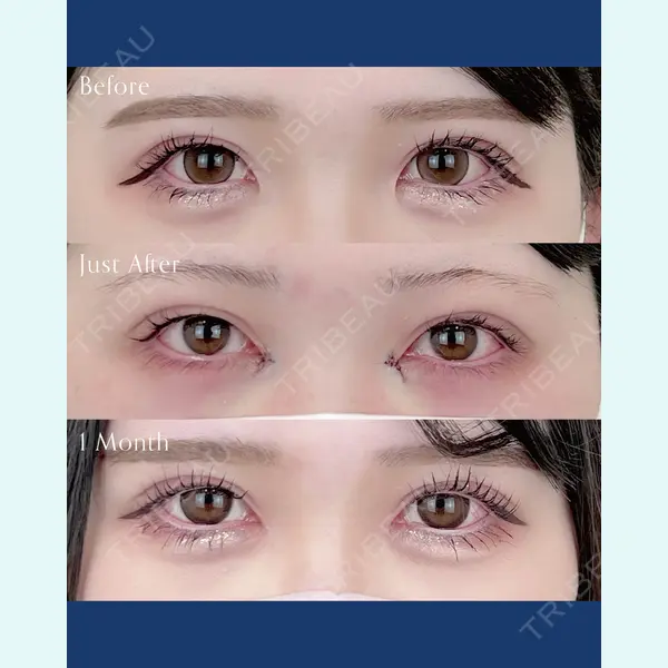 AI Beauty Clinic （エーアイ美容クリニック） 尾崎 宥文医師の症例