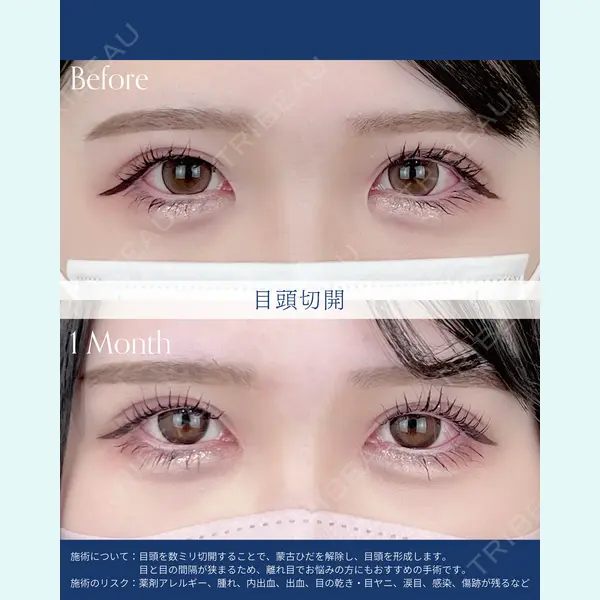 AI Beauty Clinic （エーアイ美容クリニック） 尾崎 宥文医師の症例