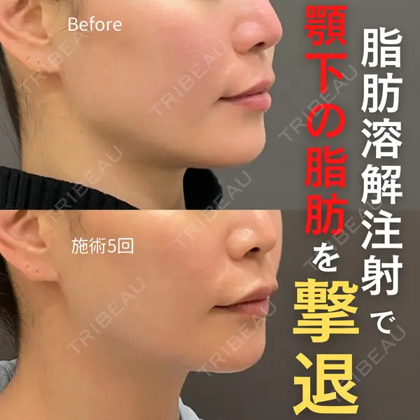 ロレシー美容クリニック 心斎橋駅前院 福留院長医師の症例