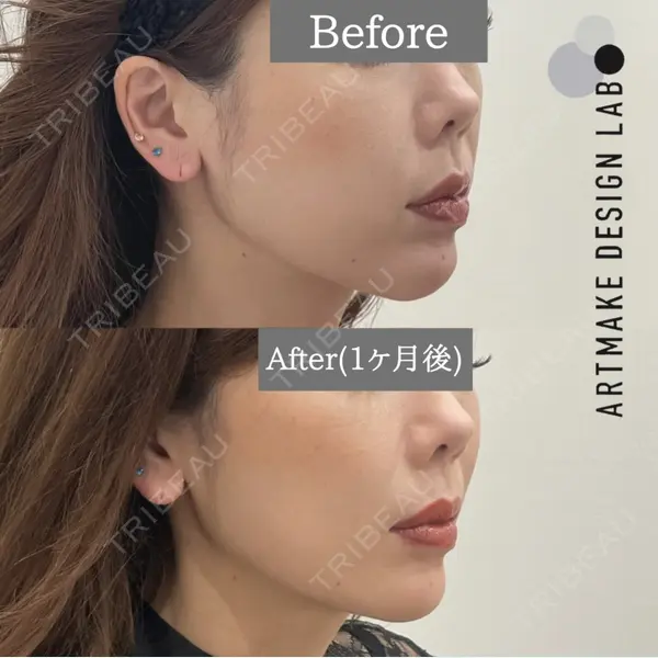 ARTMAKE DESIGN LAB 【アートメイクデザインラボ】の症例