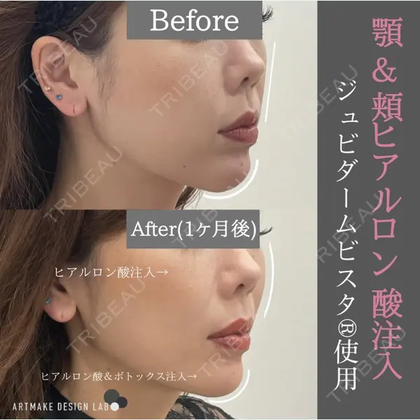 ARTMAKE DESIGN LAB 【アートメイクデザインラボ】の症例