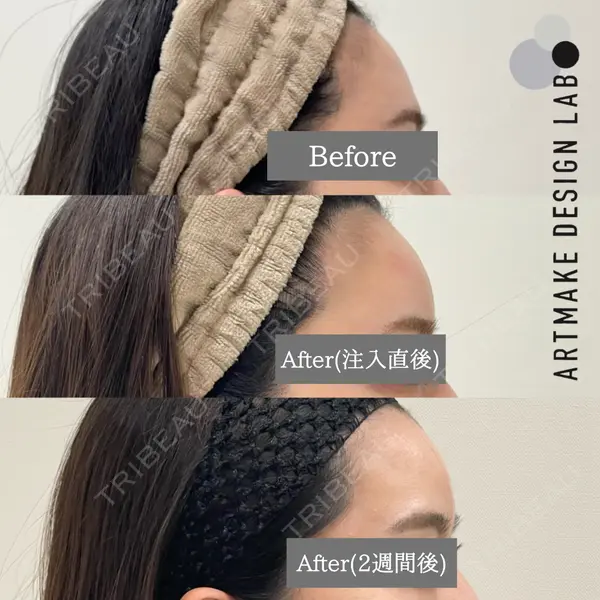 ARTMAKE DESIGN LAB 【アートメイクデザインラボ】の症例