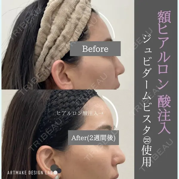 ARTMAKE DESIGN LAB 【アートメイクデザインラボ】の症例
