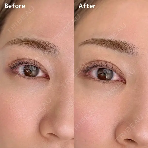 クレアージュ 福岡院の症例