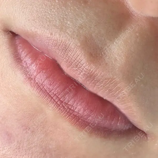 マルーンビューティースキンクリニックの症例