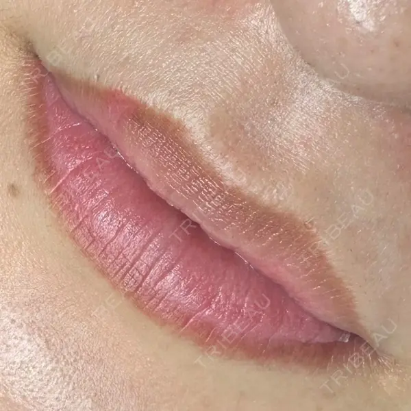 マルーンビューティースキンクリニックの症例