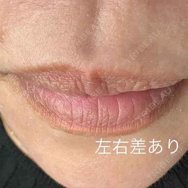 マルーンビューティースキンクリニックの症例