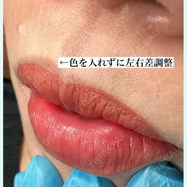 マルーンビューティースキンクリニックの症例