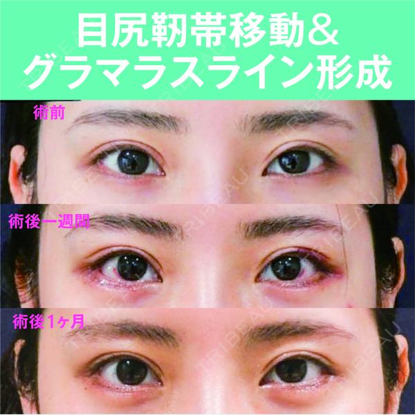 S.T styleクリニック 徳田 真紀子医師の症例