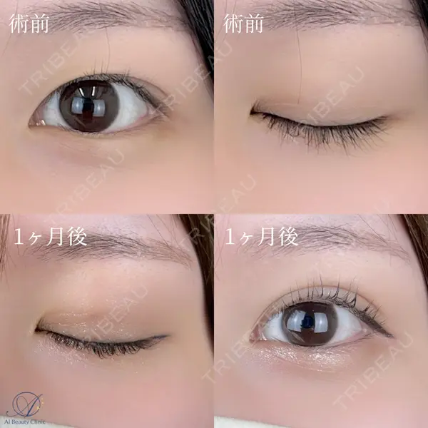 AI Beauty Clinic （エーアイ美容クリニック） 尾崎 宥文医師の症例