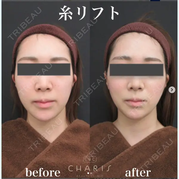 CHARIS BEAUTY CLINICの症例