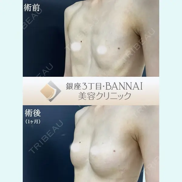 銀座3丁目・BANNAI美容クリニック 坂内 将佑貴医師の症例