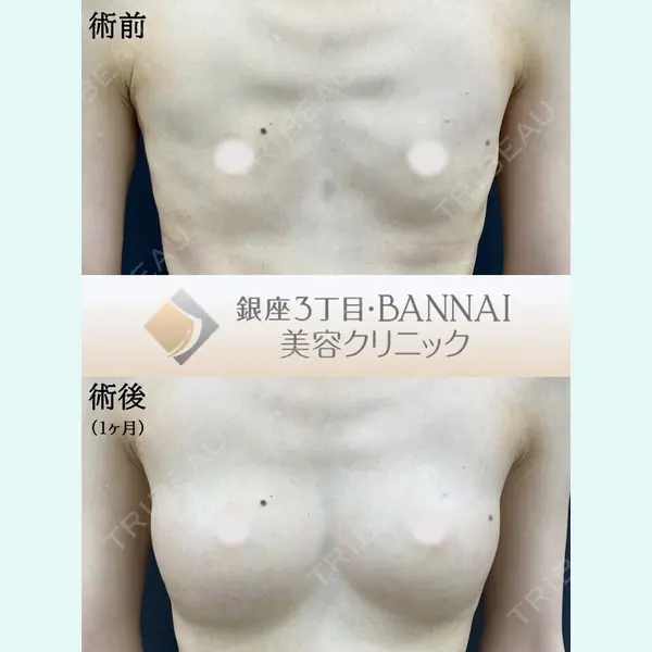 銀座3丁目・BANNAI美容クリニック 坂内 将佑貴医師の症例