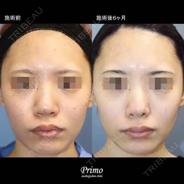 プリモ麻布十番クリニック 大場教弘医師の症例