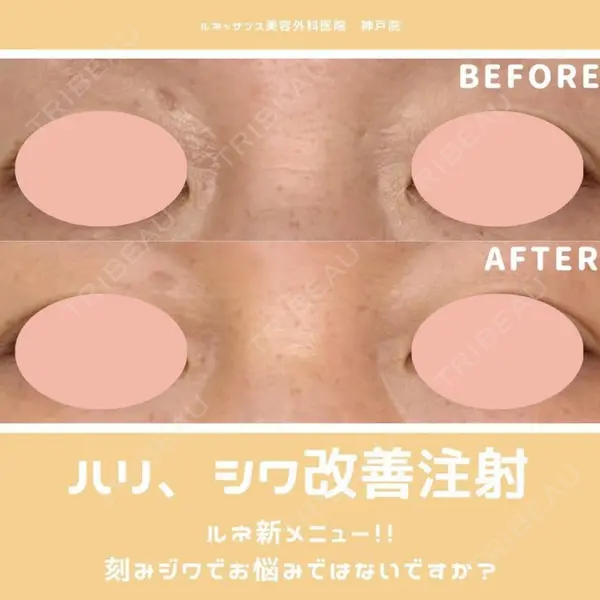 ルネッサンス美容外科医院 東京院 木谷　慶太郎医師の症例