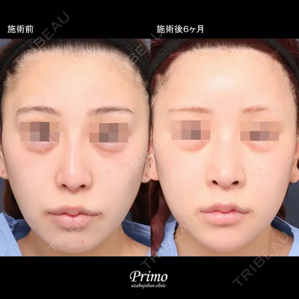 プリモ麻布十番クリニック 大場教弘医師の症例